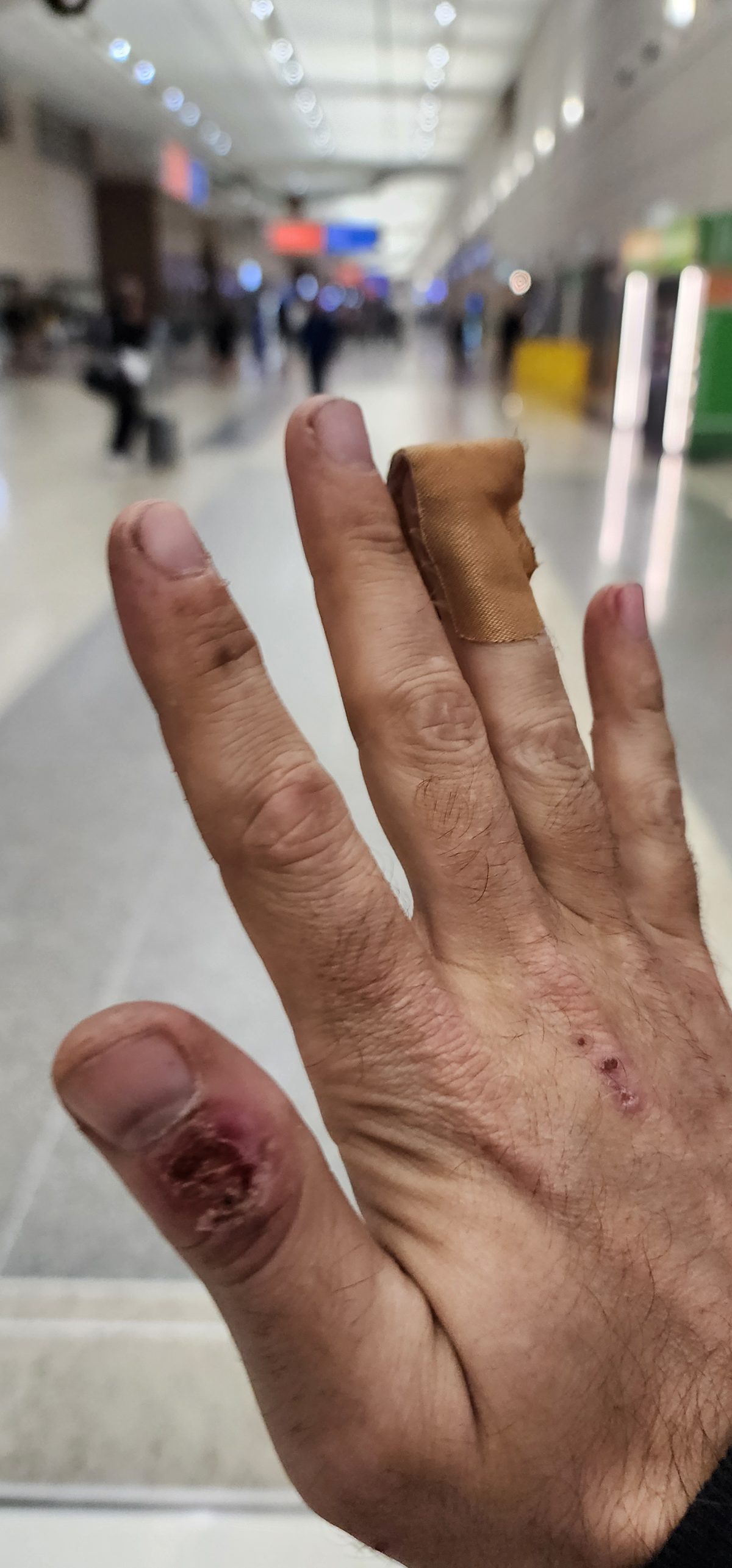 A hand with taped fingers held up in an airport terminal