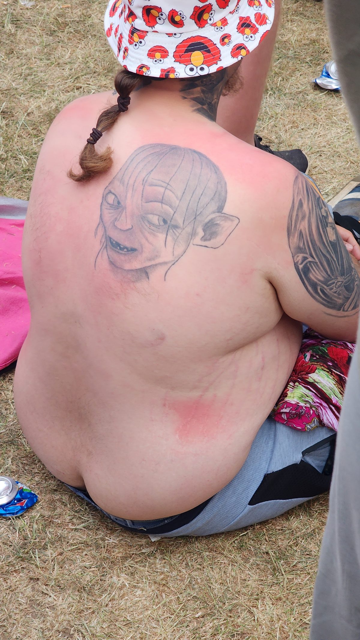 A festival-goer's sunburned back with a temporary tattoo
